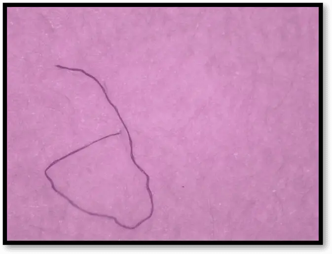 Synthetic Polymer Contamination